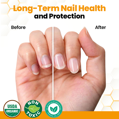 Biancat® BeeVenom Anti-Pilz-Öl zur Nagelregeneration 🌟