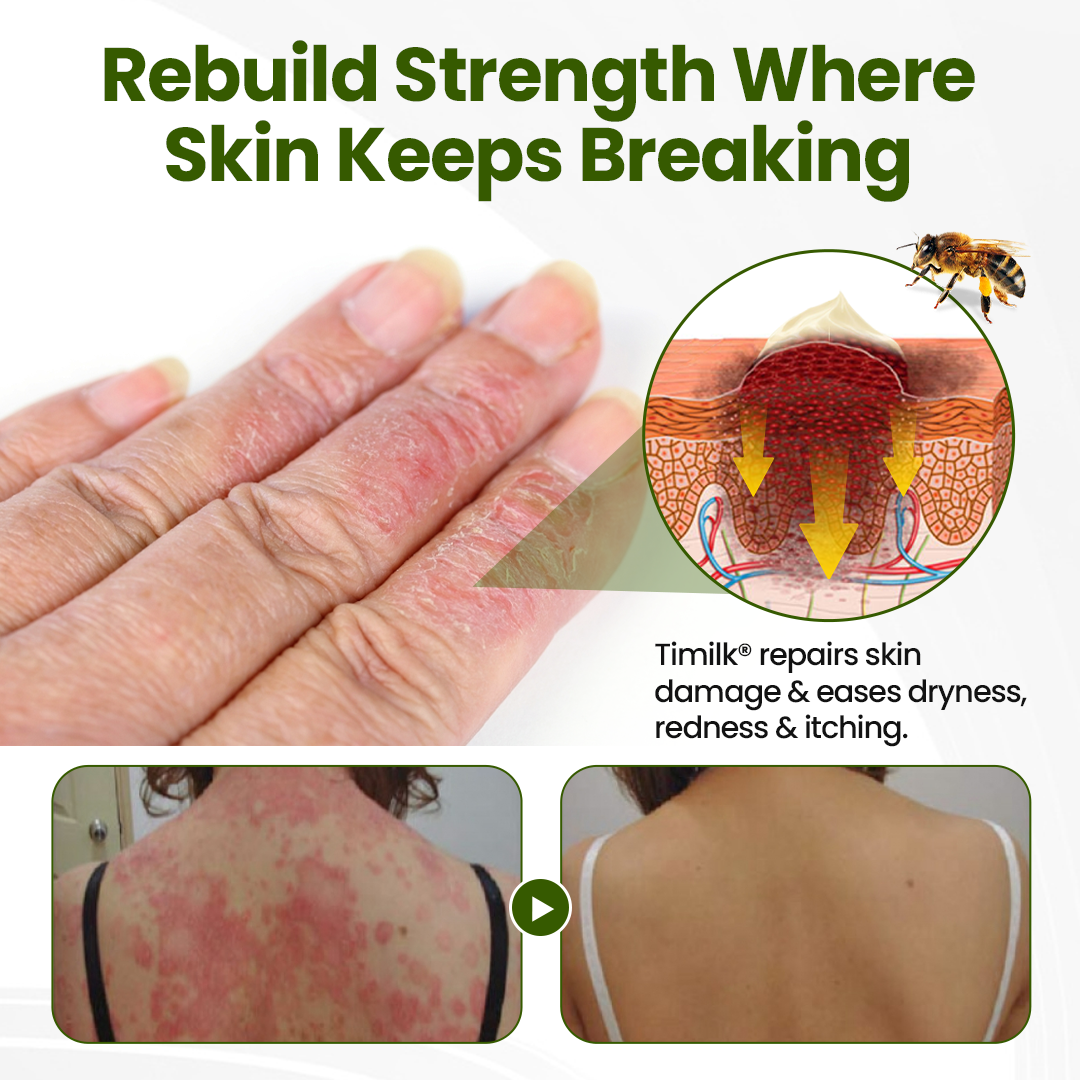 Timilk® BeePeptide RootSoft DualRelief Creme🌟
