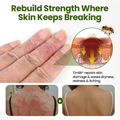 Timilk® BeePeptide RootSoft DualRelief Creme🌟