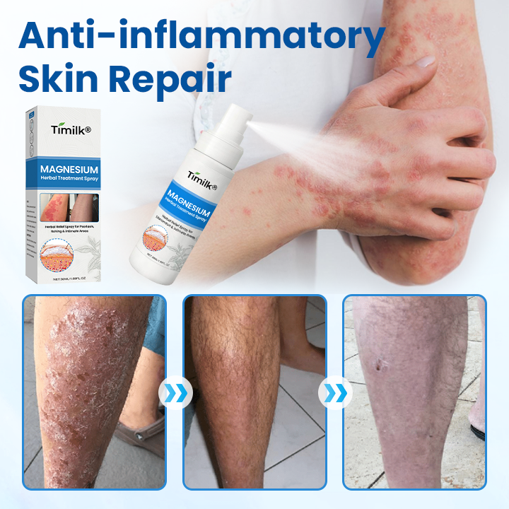 Timilk® PCA Magnesium Tiefenreparaturspray🌟