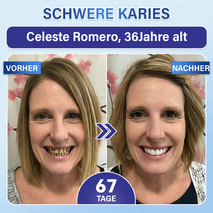 Dein Lächeln🦷Ceoerty® Zahn- und Zahnfleischpflege – schnell lösliches Mikronadel-Pflaster✨ (𝟓-𝐢𝐧-𝟏 💎 𝐙𝐚𝐡𝐧𝐬𝐜𝐡𝐦𝐞𝐥𝐳 & 𝐃𝐞𝐧𝐭𝐢𝐧 𝐖𝐢𝐞𝐝𝐞𝐫𝐚𝐮𝐟𝐛𝐚𝐮𝐞𝐧 • 𝐙𝐚𝐡𝐧𝐟𝐥𝐞𝐢𝐬𝐜𝐡 𝐒𝐭ä𝐫𝐤𝐞𝐧 • 𝐙𝐚𝐡𝐧𝐬𝐭𝐞𝐢𝐧 & 𝐌𝐮𝐧𝐝𝐠𝐞𝐫𝐮𝐜𝐡 𝐁𝐞𝐬𝐞𝐢𝐭𝐢𝐠𝐞𝐧 • 𝐙ä𝐡𝐧𝐞 𝐀𝐮𝐟𝐡𝐞𝐥𝐥𝐞𝐧 • 𝐙𝐚𝐡𝐧𝐞𝐦𝐩𝐟𝐢𝐧𝐝𝐥𝐢𝐜𝐡𝐤𝐞𝐢𝐭 𝐒𝐭𝐨𝐩𝐩𝐞𝐧)