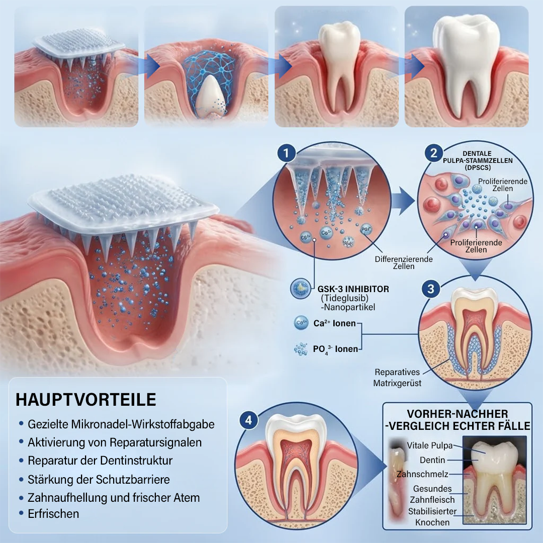 Dein Lächeln🦷Ceoerty® Zahn- und Zahnfleischpflege – schnell lösliches Mikronadel-Pflaster✨ (𝟓-𝐢𝐧-𝟏 💎 𝐙𝐚𝐡𝐧𝐬𝐜𝐡𝐦𝐞𝐥𝐳 & 𝐃𝐞𝐧𝐭𝐢𝐧 𝐖𝐢𝐞𝐝𝐞𝐫𝐚𝐮𝐟𝐛𝐚𝐮𝐞𝐧 • 𝐙𝐚𝐡𝐧𝐟𝐥𝐞𝐢𝐬𝐜𝐡 𝐒𝐭ä𝐫𝐤𝐞𝐧 • 𝐙𝐚𝐡𝐧𝐬𝐭𝐞𝐢𝐧 & 𝐌𝐮𝐧𝐝𝐠𝐞𝐫𝐮𝐜𝐡 𝐁𝐞𝐬𝐞𝐢𝐭𝐢𝐠𝐞𝐧 • 𝐙ä𝐡𝐧𝐞 𝐀𝐮𝐟𝐡𝐞𝐥𝐥𝐞𝐧 • 𝐙𝐚𝐡𝐧𝐞𝐦𝐩𝐟𝐢𝐧𝐝𝐥𝐢𝐜𝐡𝐤𝐞𝐢𝐭 𝐒𝐭𝐨𝐩𝐩𝐞𝐧)