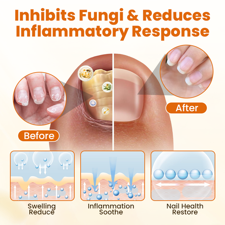 Timilk® FungiBee Fortschrittliches Nagelreparatur-Spray 🌟