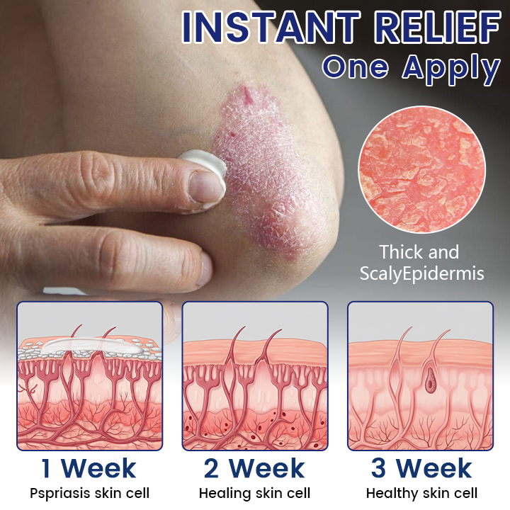 Timilk® DermaSooth Reparaturcreme🌟