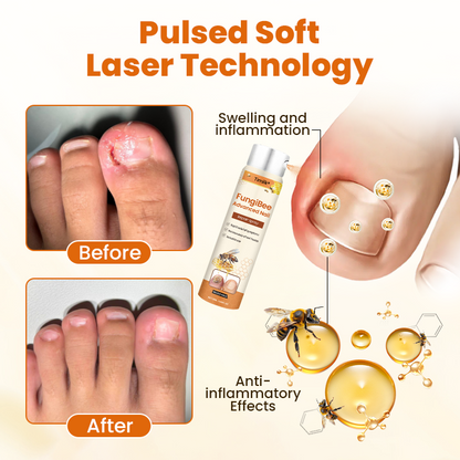 Timilk® FungiBee Fortschrittliches Nagelreparatur-Spray 🌟