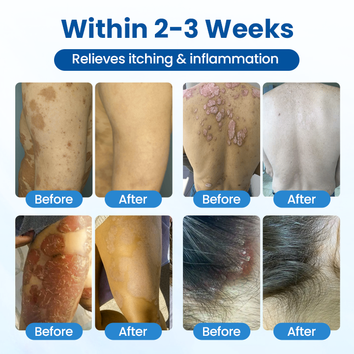 Timilk® PCA Magnesium Tiefenreparaturspray🌟