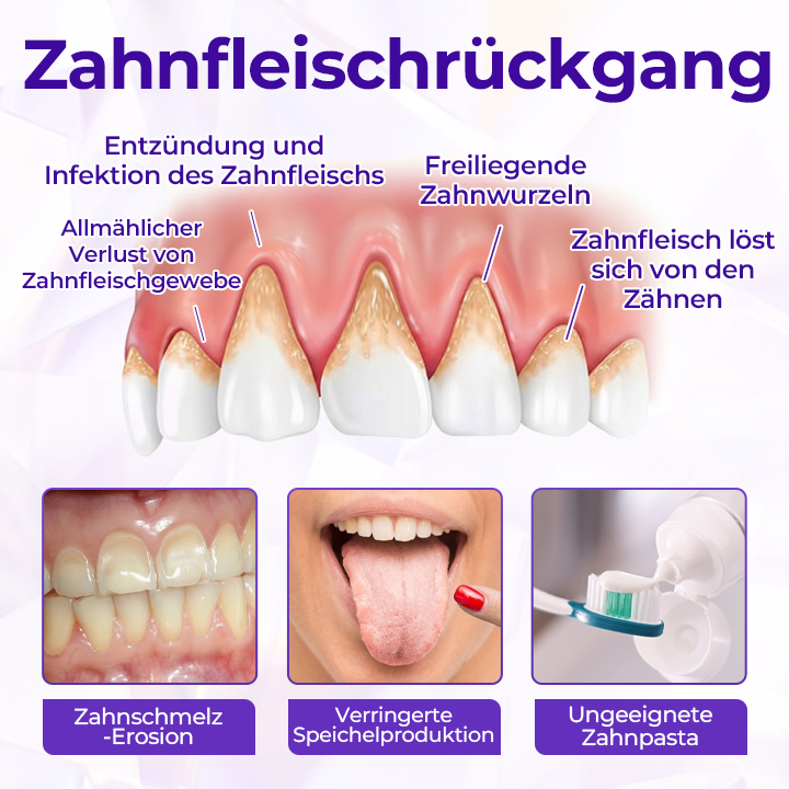 Biancat® SensiGum Fluorid-Zahnpasta