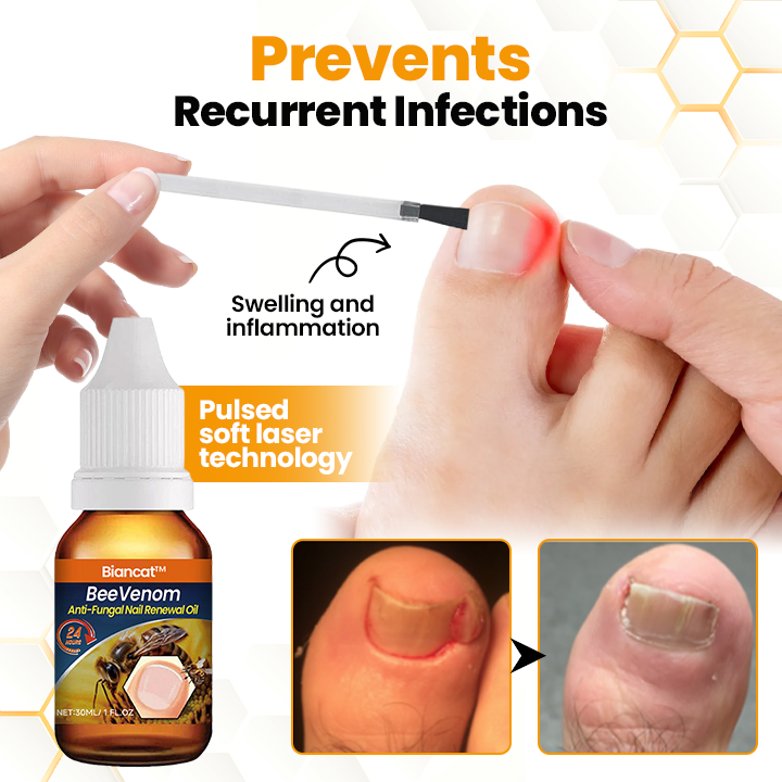 Biancat® BeeVenom Anti-Pilz-Öl zur Nagelregeneration 🌟