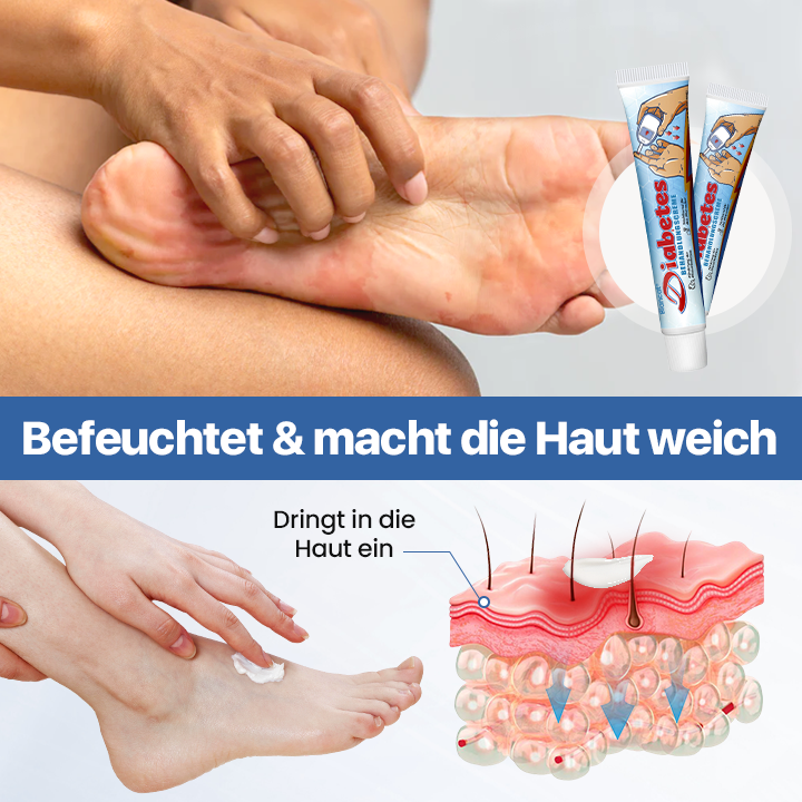 Biancat® VitaGluco Diabetes-Behandlungscreme