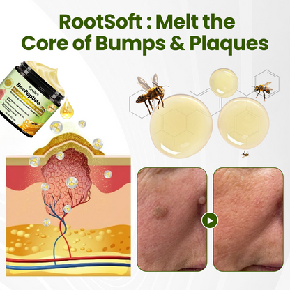 Timilk® BeePeptide RootSoft DualRelief Creme🌟