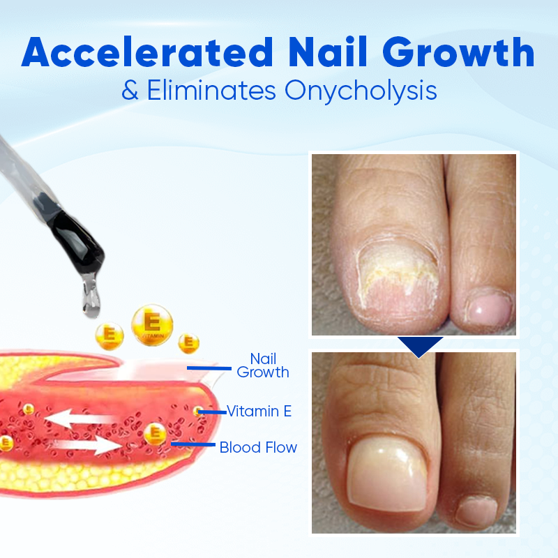 Biancat® OnyxoGuard Serum für Nagelwachstum und -regeneration 🌟