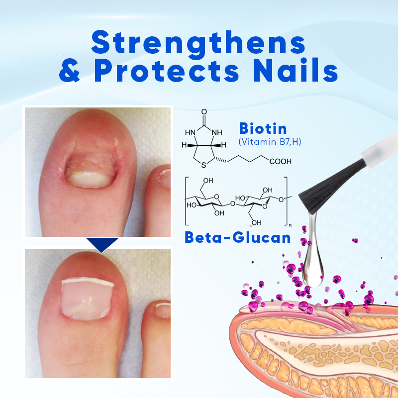 Biancat® OnyxoGuard Serum für Nagelwachstum und -regeneration 🌟